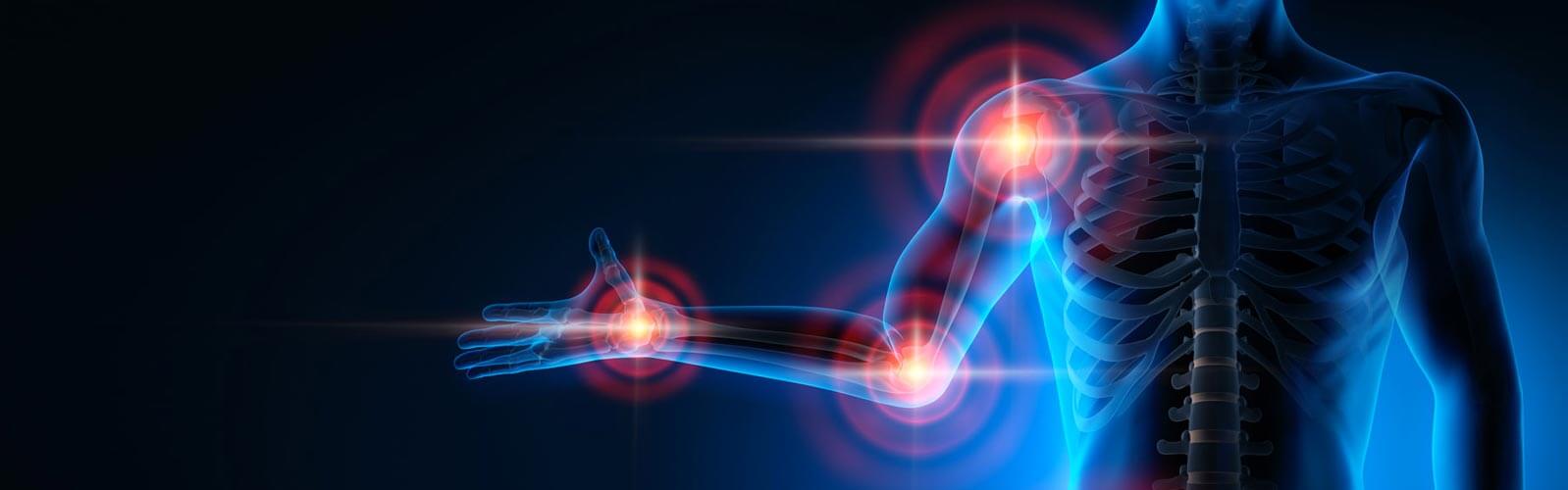 anova institute for regenerative medicine - Risikofaktoren bei Arthrose